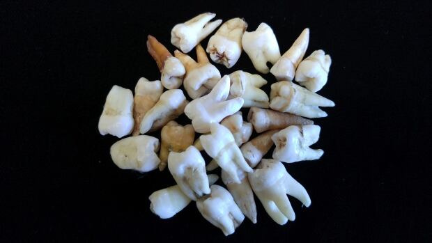ancient teeth