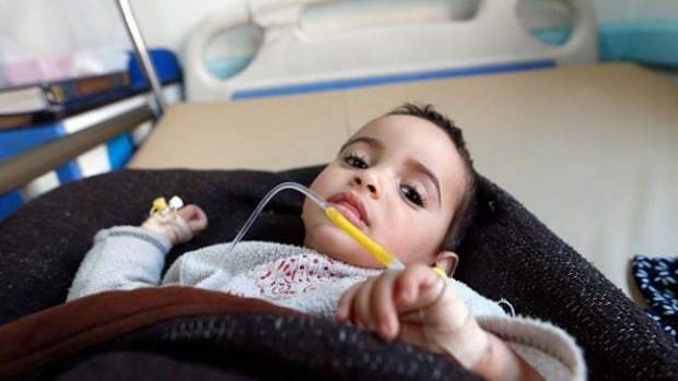A Yemeni child suspected of being infected with cholera receives treatment at Sabaeen Hospital in Sanaa. Yemen is struggling with its second outbreak of the deadly disease in less than a year.