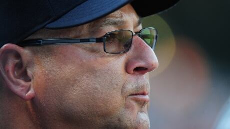 Terry Francona underwent a procedure to correct a heart arrhythmia and will not manage the American League all-star team. francona-terry-070717
