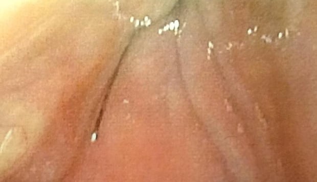 Wire bristle close up