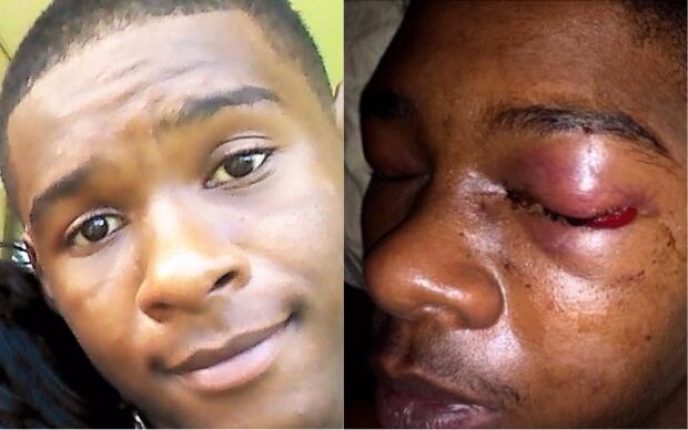 Dafonte Miller Durham police beating split image 2