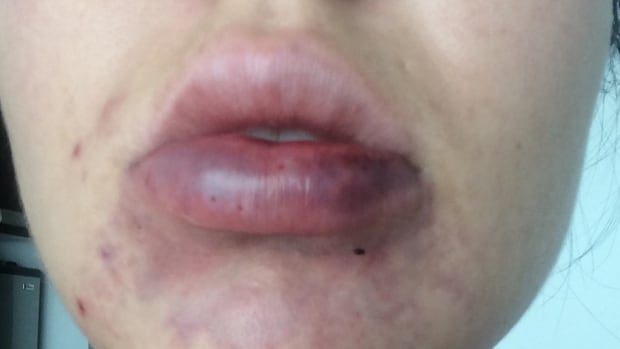 After-mouth-2
