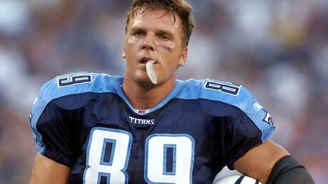 Former Tennessee Titans Frank Wycheck accepts that he likely has CTE after 11 years in the National Football League. TITANS WYCHECK
