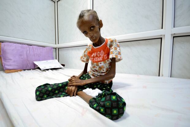 YEMEN-SECURITY/HEALTH