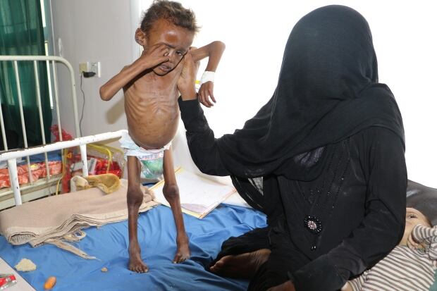 YEMEN-SECURITY/