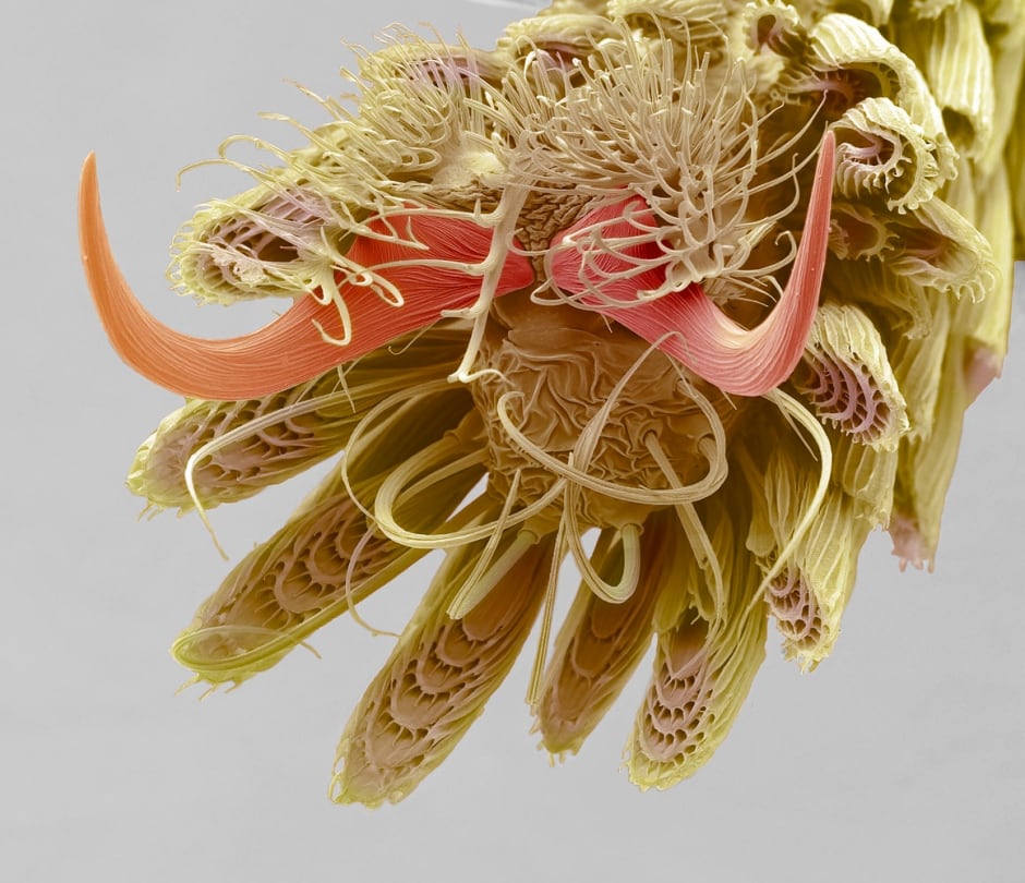 Mosquito Foot, Steve Gschmeissner
