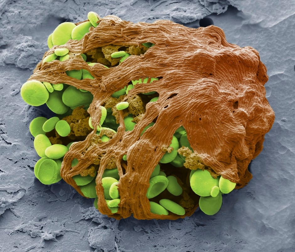 Chloroplasts, Steve Gschmeissner