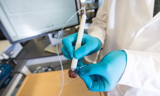 MassSpec Pen