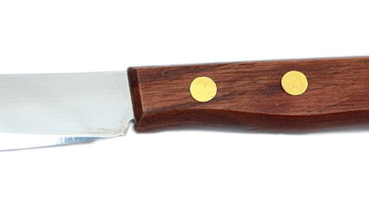 St. Thomas police officer struck by flying butter knives