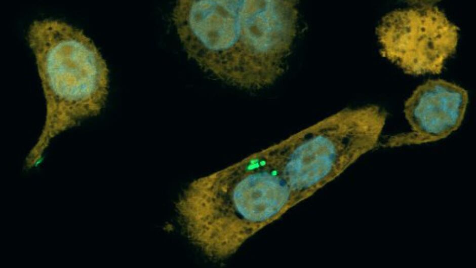 Pancreatic cancer cells with bacteria (in fluorescent green) within them.