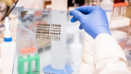 Researchers from the University of British Columbia are retracting their scientific paper linking aluminum in vaccines to autism in mice, because one of the co-authors claims figures published in the study — showing photos of Western blots — were deliberately altered before publication. blots science lab
