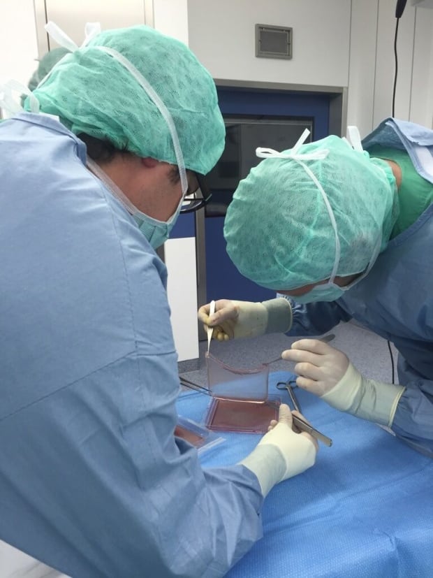 Skin transplant procedure