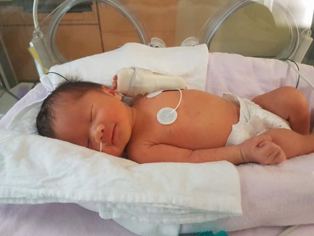 Baby Eiko in Mount Sinai NICU