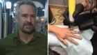 Ben Alway of Second Skin Tattoo Removal