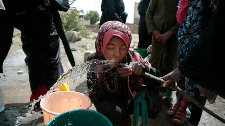A girl drinks water from a well that alleged to be contaminated water with the bacterium Vibrio cholera, on the outskirts of Sanaa on July 12, 2017. Yemen's raging two-year conflict has served as an incubator for lethal cholera. Mideast Year in Photos 2017