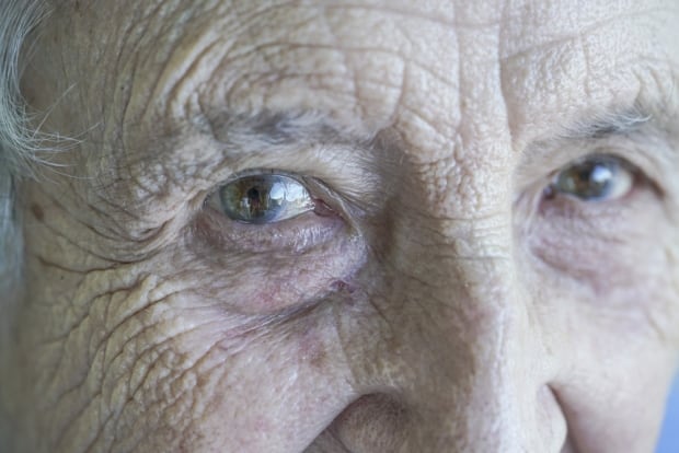 Elderly person