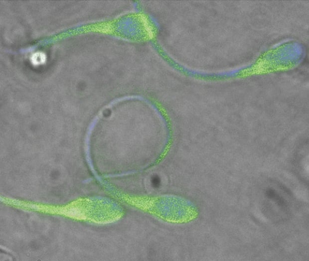 Normal human sperm