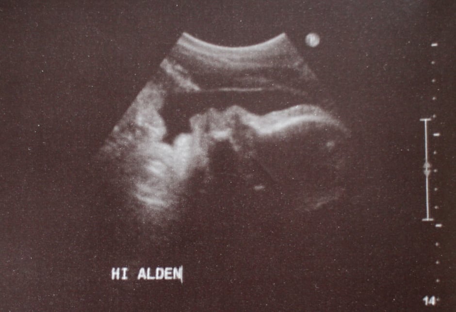 Hi Alden ultrasound