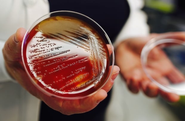 Strep A bacteria in petri dish