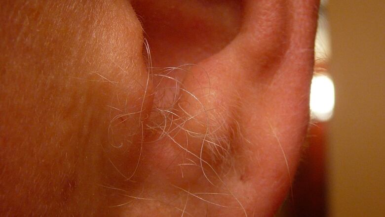 Why Does Ear Hair Grow As Men Age CBC Radio Why Does Ear Hair Grow As Men Age CBC Radio