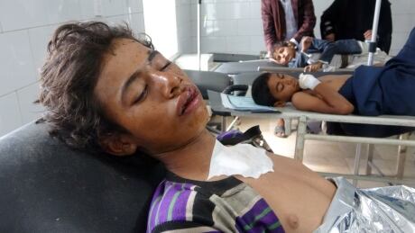 Yemeni boys, injured in an air raid on a wedding party in Yemen, receive treatment at a hospital in Yemen's Hajjah province on April 23, 2018. - Dozens were killed and wounded in an air raid on a wedding party in Yemen, local officials said Monday, with Huthi rebels blaming a Saudi-led military coalition. AFP_14948Y