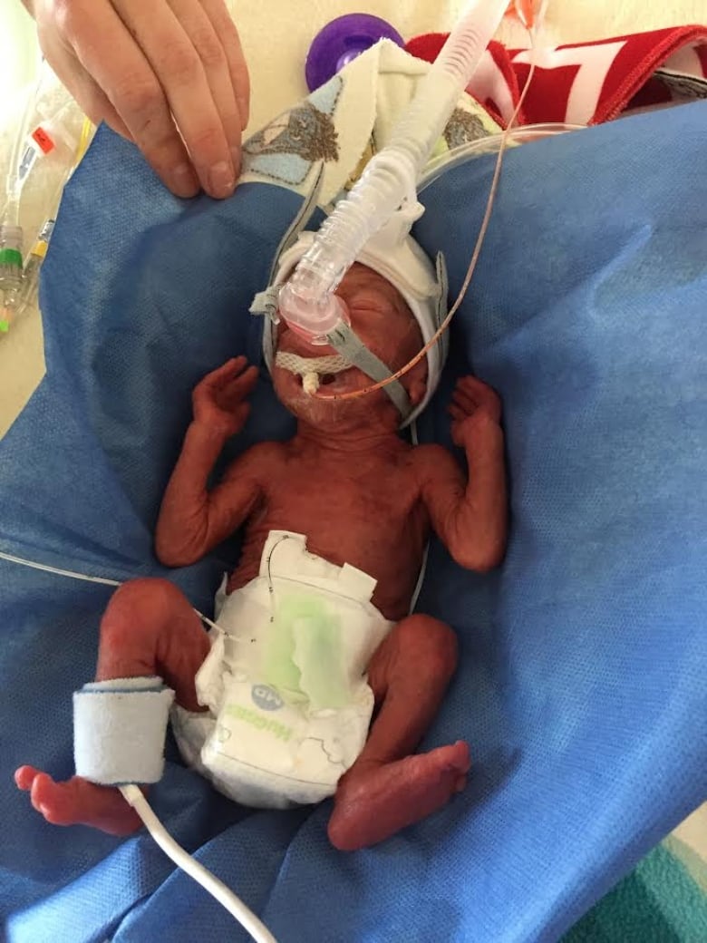 premature baby birth