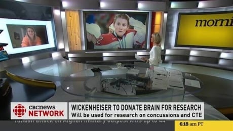 CBC's Heather Hiscox goes one-on-one with Hayley Wickenheiser about her decision to donate her brain to concussion research. Hayley Wickenheiser discusses decision to donate brain to concussion research