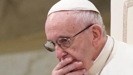 FILE - In this Aug. 22, 2018 file photo, Pope Francis is caught in pensive mood during his weekly general audience at the Vatican. Francis' papacy has been thrown into crisis by accusations that he covered-up sexual misconduct by ex-Cardinal Theodore McCarrick. Vatican Sex Abuse Q&A