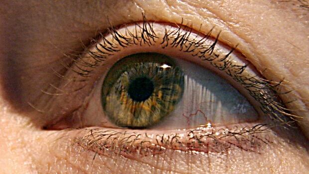 When this eye blinks, the brain will fill in the gaps in visual perception. .