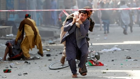 A man caries a wounded person to the hospital after a blast in Jalalabad on Monday. Dozens were injured in a series of explosion, authorities said. AFGHANISTAN-BLAST/