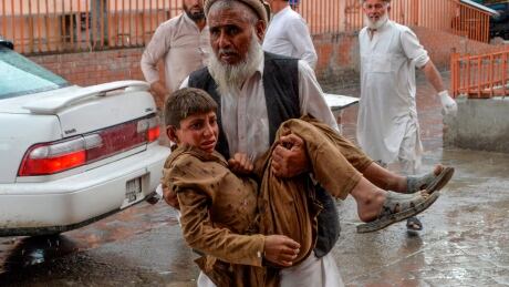 A volunteer carries an injured youth to hospital, following a bomb blast in Haska Mina district of Nangarhar on Friday.
1176504679