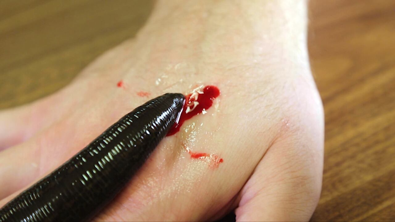 leech blood leech blood