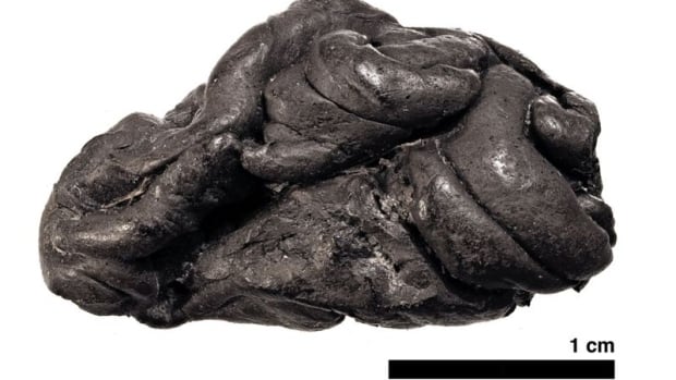 Ancient chewing gum reveals reveals identity of chewer and what she ate - CBC.ca