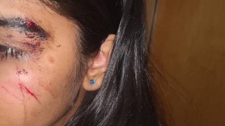 A woman and her 14-year-old daughter claim an RCMP officer threatrened to arrest her daughter if she pursued assault charges against the boy who allegedly punched her. 14-year-old assaulted