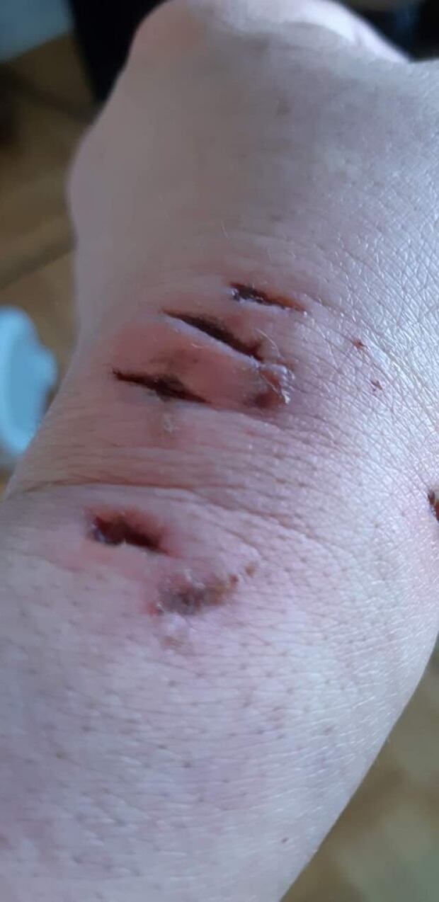 City tribunal declares Rottweiler mix a dangerous dog after woman badly