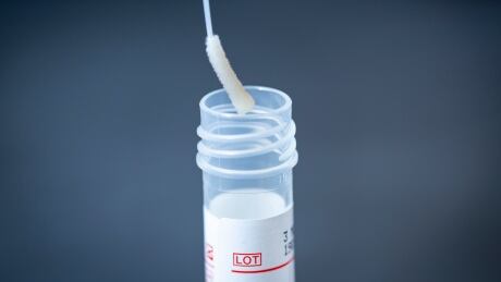 COVID-19 test kits are pictured on March 11, 2020, the day the WHO declared coronavirus a pandemic. COVID-19 TEST KITS