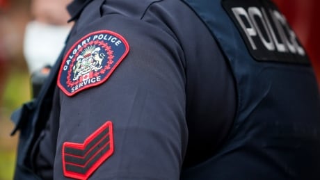 A Calgary Police Service officer is seen in Calgary, Alta., Tuesday, April 14, 2020, amid a worldwide COVID-19 pandemic. Calgary police badge