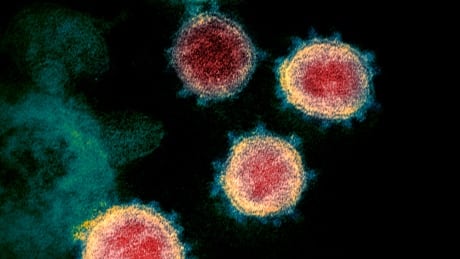 Alberta reports 18 new COVID-19 cases with no additional deaths. COVID Science Misinformation 20200421