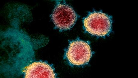 An undated electron microscope image made available by the U.S. National Institutes of Health in February 2020 shows the virus that causes COVID-19. COVID Science Misinformation 20200421