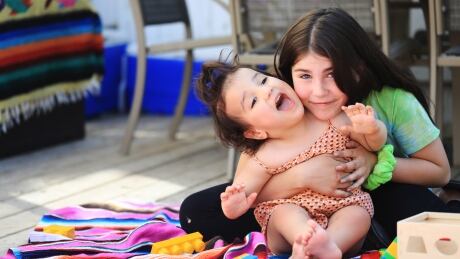 Callie Tomilin and her little sister Mila play in their backyard. Tomilin's tie-dye project is raising funds for her little sister's genetic condition called Joubert syndrome. Callie Tomilin