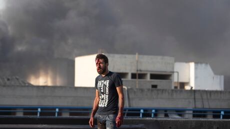 An injured man stands after a massive explosion in Beirut, Lebanon, Tuesday, Aug. 4, 2020. Massive explosions rocked downtown Beirut on Tuesday, flattening much of the port, damaging buildings and blowing out windows and doors as a giant mushroom cloud rose above the capital. Witnesses saw many people injured by flying glass and debris. (AP Photo/Hassan Ammar) Lebanon Explosion