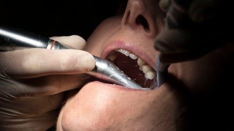 A dentist wearing protective equipment treats a patient in his dental clinic in Guebwiller, eastern France, on May 20, 2020, France eases lockdown measures taken to curb the spread of the COVID-19 disease caused by the novel coronavirus. (Photo by SEBASTIEN BOZON / AFP) (Photo by SEBASTIEN BOZON/AFP via Getty Images) 1214247399