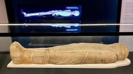 The ROM's Egyptian Mummies exhibit features Nestawedjat, a married woman whose body was carefully mummified and has undergone advanced CT scans to reveal her inner remains. Mummies