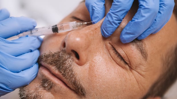 A nose job without the knife? Doctors say 'liquid rhinoplasty' isn't worth  the risk | CBC News