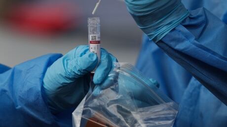 Health workers place a swab in a tube after taking a nasal sample from a pedestrian for COVID-19 during a free, government testing campaign in Panama City, Friday, Jan. 15, 2021. Panama is waiting for its first shipment of doses of the vaccine against the new coronavirus, expected next week. Virus Outbreak Panama
