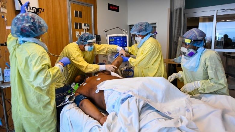 icu patient on ventilator