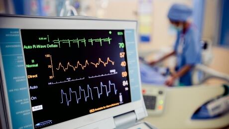 Dr. Susan Shaw is optimistic about the future but thinks the next few weeks will be challenging.
Shutterstock - EKG monitor at ICU in hospital