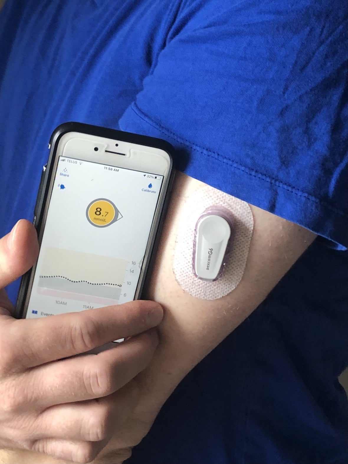 N.S. woman pushes province to cover glucose monitors for diabetics