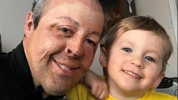 For this dad, Father's Day is a reminder of the power of unconditional acceptance