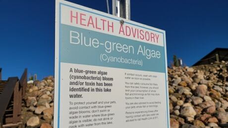 Blue Green algae in an Alberta lake. See health advisory sign. Taken on October 5, 2020. Blue Green Algae